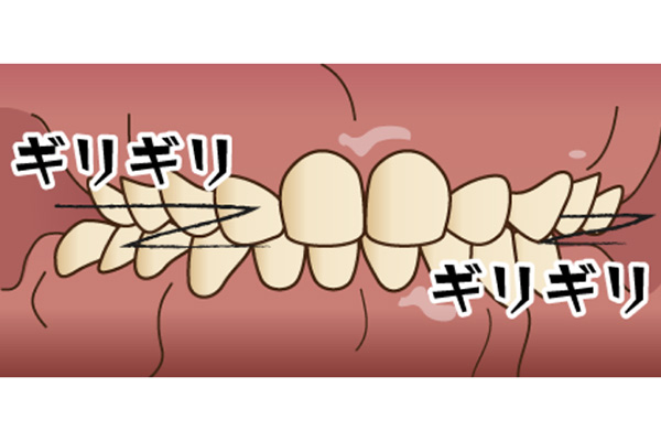 ギリギリと歯ぎしりしているイラスト