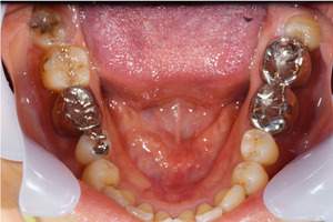 治療前（上から見た写真）