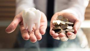 インプラント費用