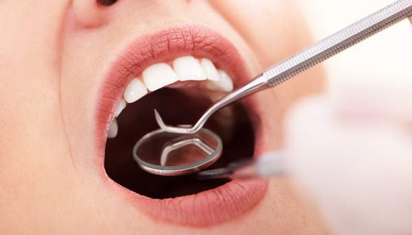 口腔内の状況を歯科用器具を使用して確認しているイメージ