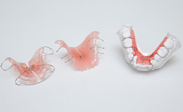 矯正治療で用いる矯正装置の模型