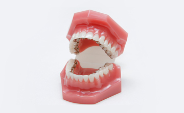 歯の模型を用いた歯が動く仕組み