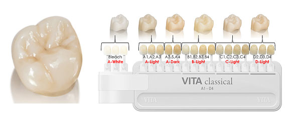 ジルコニアステイン
