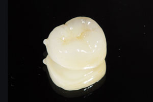 オールセラミック スタンダード