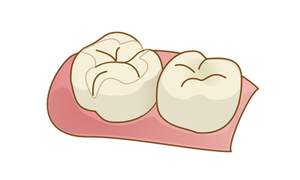 仮フタをしたイラスト