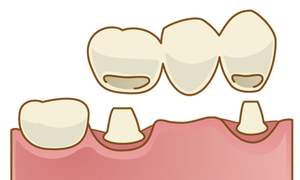 ブリッジのイラスト