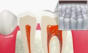 虫歯になる一歩手前の歯の断面図