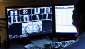 基本検査とインプラント検査