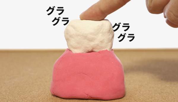 小児の虫歯治療