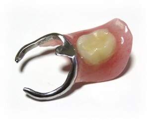 歯が欠損した箇所に入れる部分入れ歯の模型