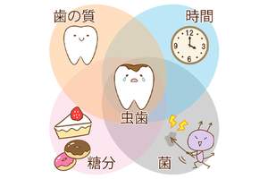 虫歯ができるメカニズムのイラスト