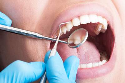 麻布十番の歯医者さんで歯の検診を受けているイメージ