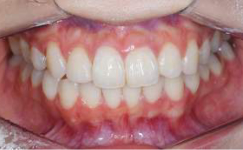 麻布十番の歯医者さんで口腔内写真を撮影する機械