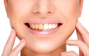 ホワイトニングの効果