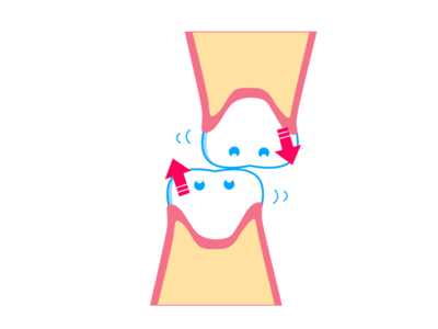 歯のぐらつきによりかみ合わせや歯ならびが変化するイメージ