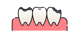 虫歯になっている歯のイラスト