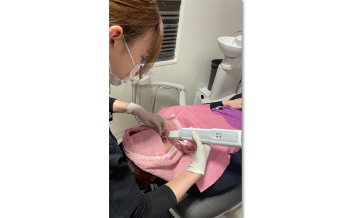 口腔内スキャン・虫歯チェック